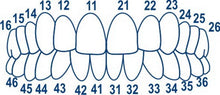 Anterior Transparent Crowns Matrices Matrix 64 pcs. TOR VM