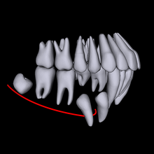 Free 1 month unlimited use With ORCA's AI 3D Segmentation analysis from any CBCT scans!